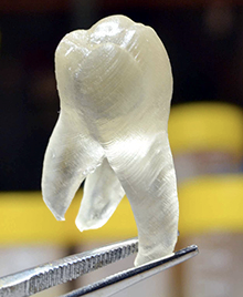 3D打印树脂可生产抗菌牙齿修复材料