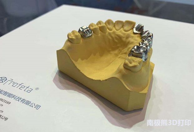 金属3D打印齿科,北大口腔-南京前知签约专利转
