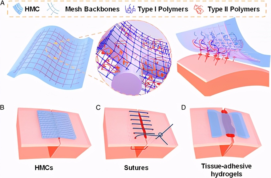 《pnas》哈佛大学锁志刚院士:用于伤口闭合水凝胶-网状复合材料