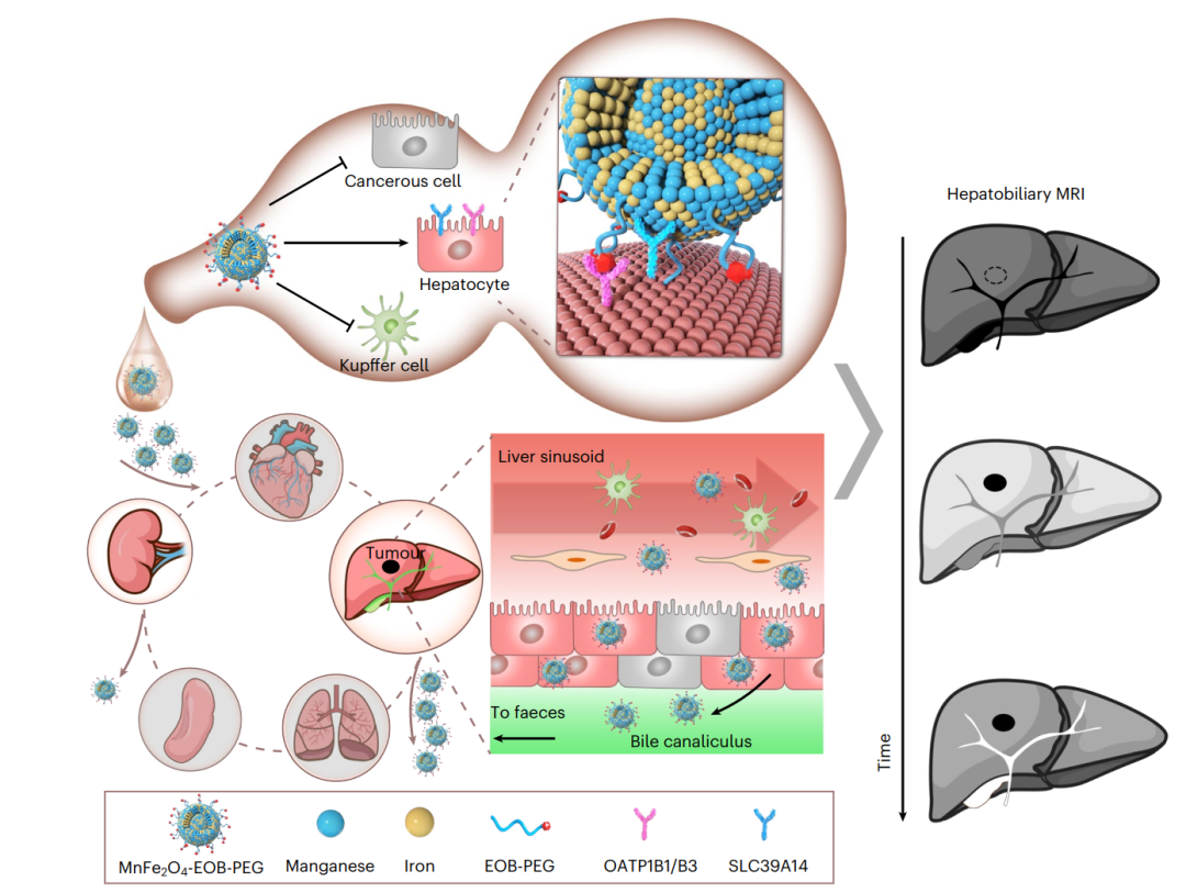 Nature Biomedical Engineering: 超小纳米颗粒造影剂，利用磁共振可诊断早期肝癌