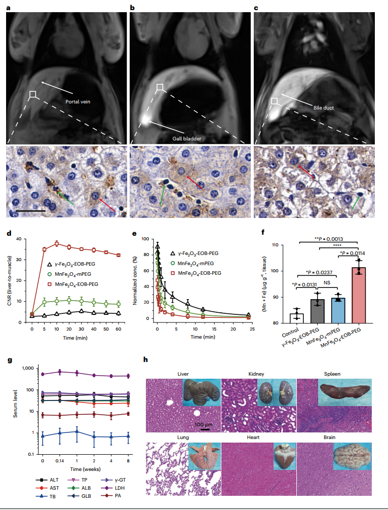 Nature Biomedical Engineering: 超小纳米颗粒造影剂，利用磁共振可诊断早期肝癌