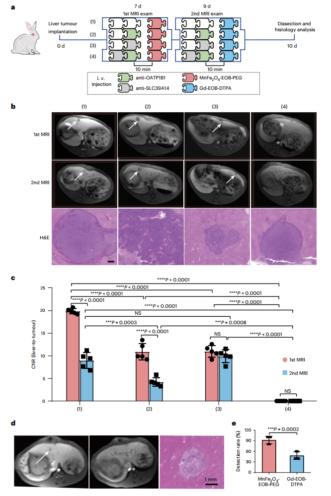 Nature Biomedical Engineering: 超小纳米颗粒造影剂，利用磁共振可诊断早期肝癌