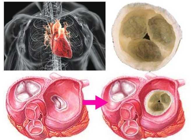 pha人工心脏瓣膜图片来源: 蓝晶实验室pha可用于制造能分解的纤维和