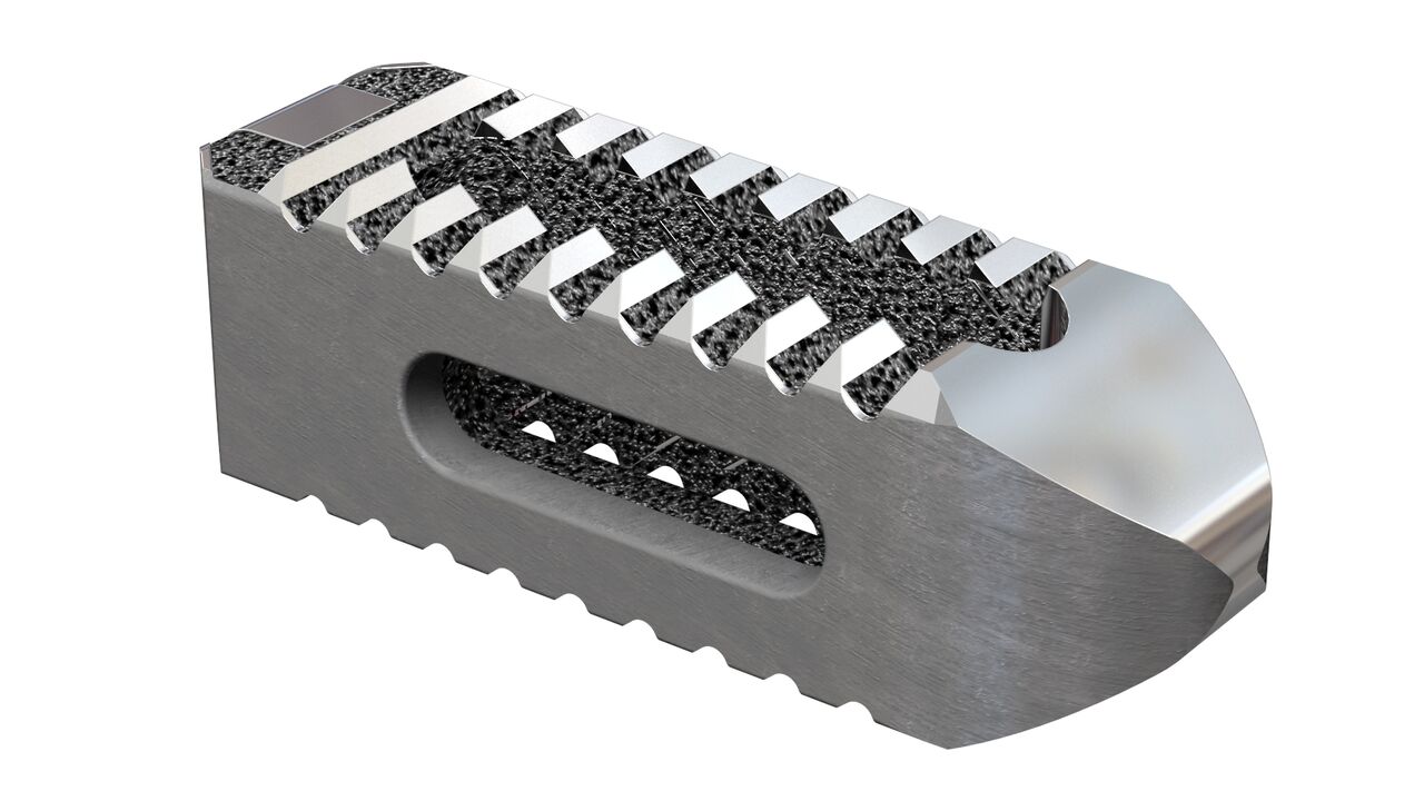 在新的动物研究中，3D打印的钛脊椎笼打败PEEK笼