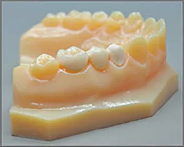 3D打印在牙科领域的应用案例分享