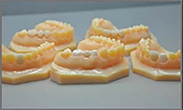 3D打印在牙科领域的应用案例分享