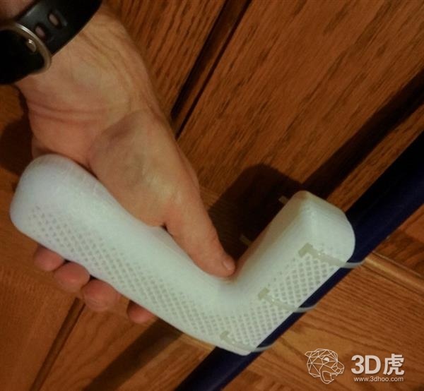 密歇根理工大学通过3D打印辅助治疗关节炎患者